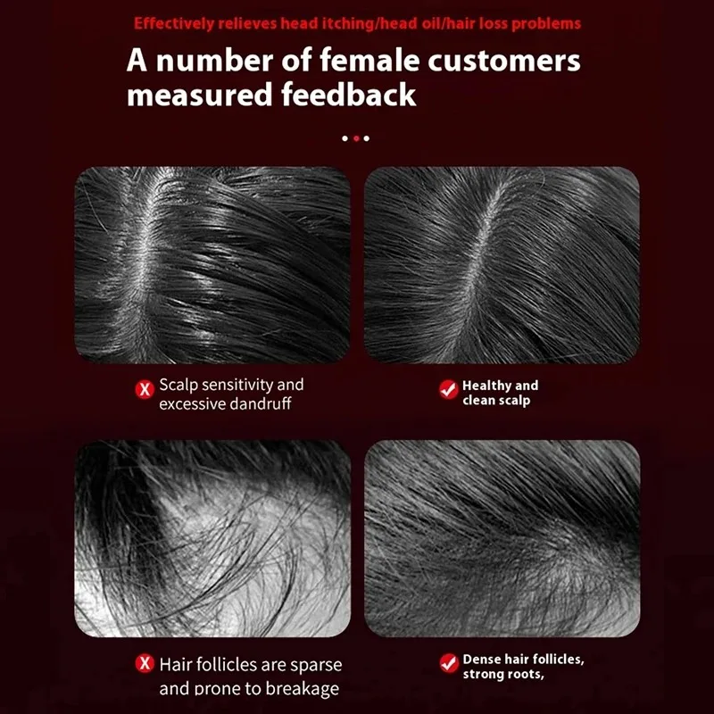 Электрическая вибрационная мас – обзор и цена Hair Care For Hair Loss