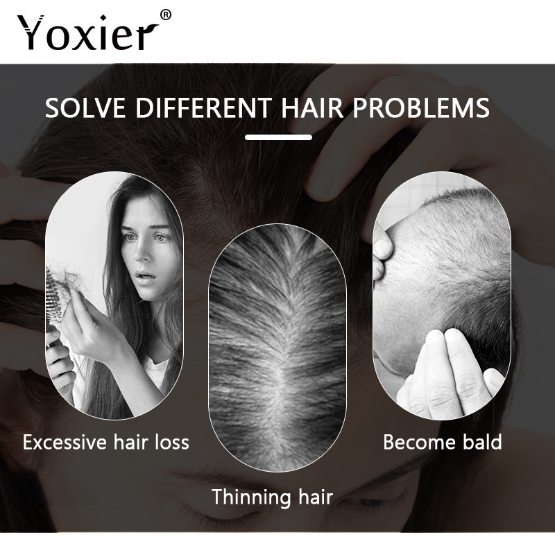 Сыворотка для интенсивного рос – обзор и цена Hair Care For Hair Loss