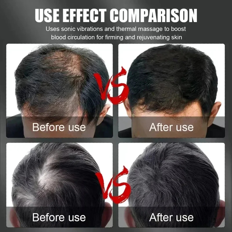 Шапка для терапии волос красны – обзор и цена Hair Care For Hair Loss